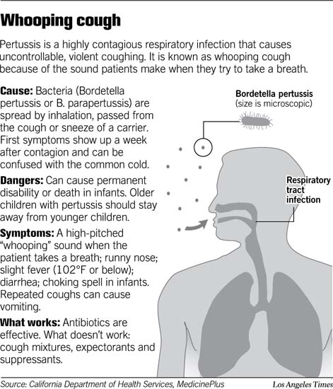 Whooping Cough/Pertussis What you need to know  MyBelize.Net
