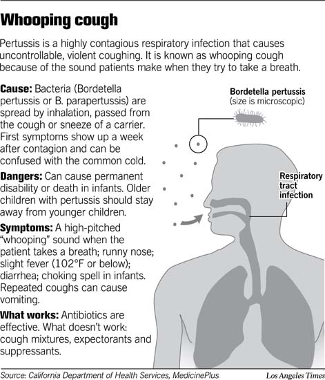 whooping-cough-pertussis-what-you-need-to-know-mybelize-net